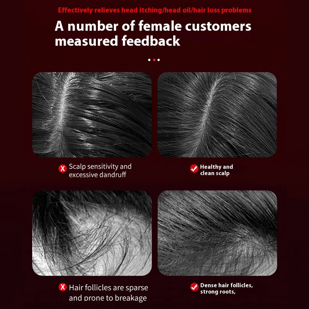 ROOTRICH™ Red Light Massage Comb 3 in 1